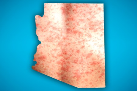 Kids in these Valley areas are at highest risk of catching measles