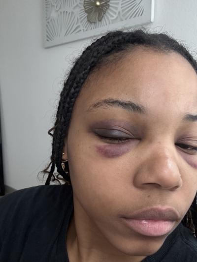 Lawyer: Tempe shouldn't charge ASU cheerleader Tempe cops beat up