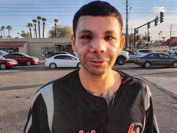 Video: Arizona Police Dog Chewed Half Man’s Face Off. He’s Seeking $2 Million.